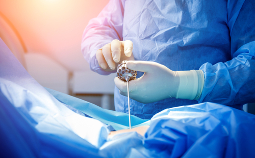 Microdiscectomy Spine Surgery: Herniated Disc Pain Relief